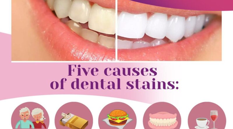 Did you know dental stains have different causes? Keep your smile bright and healthy!